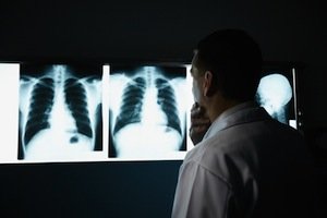 Negligencia y Errores de Radiología